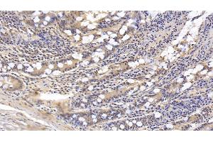 Detection of FAPa in Human Small intestine Tissue using Monoclonal Antibody to Fibroblast Activation Protein Alpha (FAPa)