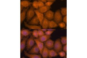 Immunofluorescence analysis of HeLa cells using ZC3H7A antibody (ABIN6131068, ABIN6150400, ABIN6150401 and ABIN6217095) at dilution of 1:100.