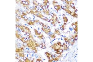 Immunohistochemistry of paraffin-embedded human liver using GATM Rabbit pAb (ABIN6133283, ABIN6140984, ABIN6140985 and ABIN6222282) at dilution of 1:100 (40x lens). (GATM anticorps  (AA 124-423))