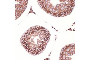 Immunohistochemistry of paraffin-embedded rat testis using Peroxiredoxin 4 (PRDX4) (PRDX4) Rabbit mAb (ABIN7269238) at dilution of 1:100 (40x lens). (Peroxiredoxin 4 anticorps)