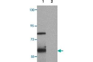 Western blot analysis of TYW1 in human lung tissue lysate with TYW1 polyclonal antibody  at 1 ug/mL. (TYW1 anticorps  (C-Term))