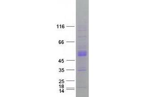 Validation with Western Blot