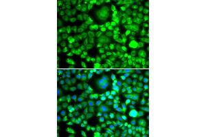 Immunofluorescence analysis of MCF-7 cells using BLID antibody (ABIN5974377).