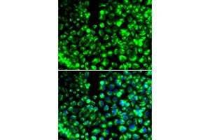 Immunofluorescence analysis of HeLa cells using CALU antibody (ABIN6291516). (CALU anticorps)