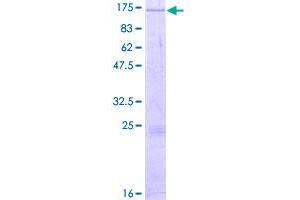 Image no. 1 for Diacylglycerol Kinase, zeta (DGKZ) (AA 1-929) protein (GST tag) (ABIN1351522)