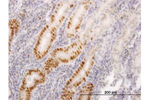 Immunoperoxidase of monoclonal antibody to LIG1 on formalin-fixed paraffin-embedded human stomach. (LIG1 anticorps  (AA 810-919))