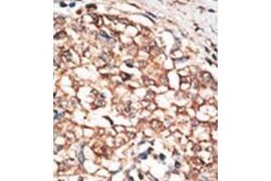 Image no. 2 for anti-Bone Morphogenetic Protein Receptor, Type IB (BMPR1B) (C-Term) antibody (ABIN357379)