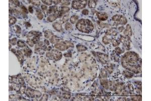 Immunoperoxidase of monoclonal antibody to ASB8 on formalin-fixed paraffin-embedded human pancreas.
