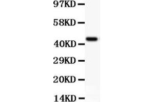 Western blot analysis of CD11b using anti-CD11b antibody (ABIN3043258).