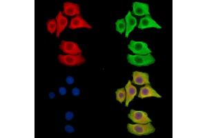 ABIN7096068 and ABIN7100130 staining Hela cells by IF/ICC. (CRISPLD2 anticorps)