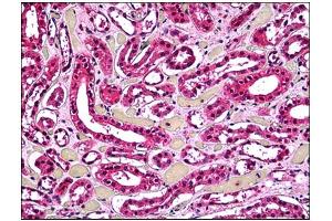 Immunohistochemistry (IHC) image for anti-Acid Phosphatase 2, Lysosomal (ACP2) antibody (ABIN781949)