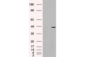 Image no. 4 for anti-Mitogen-Activated Protein Kinase Kinase 4 (MAP2K4) antibody (ABIN1499482)