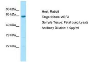 Image no. 1 for anti-Arylsulfatase J (ARSJ) (C-Term) antibody (ABIN6750084) (ARSJ anticorps  (C-Term))