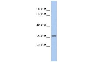CACNG6 antibody used at 1 ug/ml to detect target protein. (CACNG6 anticorps  (N-Term))