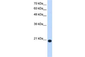 UXT antibody used at 1. (UXT anticorps  (N-Term))