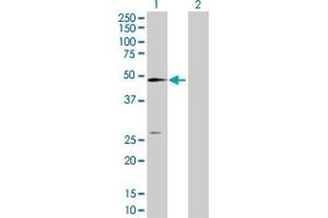 Western Blot analysis of NT5C2 expression in transfected 293T cell line by NT5C2 MaxPab polyclonal antibody. (NT5C2 anticorps  (AA 1-561))