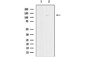 anti-Retinoblastoma-Like 1 (p107) (RBL1) (C-Term) antibody