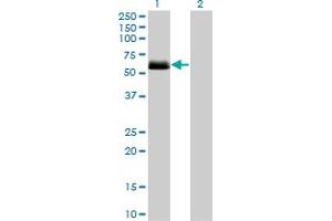 Western Blot analysis of CSNK1G2 expression in transfected 293T cell line by CSNK1G2 monoclonal antibody (M08), clone 2F5. (Casein Kinase 1 gamma 2 anticorps  (AA 315-415))
