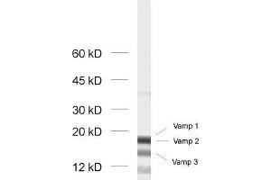 dilution: 1 : 1000, sample: rat brain homogenate (VAMP1, 2, 3 (AA 1-81) anticorps)
