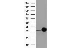 HEK293T cells were transfected with the pCMV6-ENTRY control (Left lane) or pCMV6-ENTRY CLPP (Right lane) cDNA for 48 hrs and lysed.