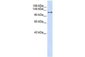 Western Blot showing XPO5 antibody used at a concentration of 1-2 ug/ml to detect its target protein. (XPO5 anticorps  (N-Term))