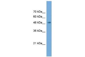 WB Suggested Anti-NPTX2 Antibody Titration: 0. (NPTX2 anticorps  (N-Term))