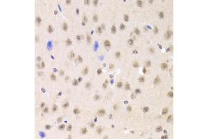 Immunohistochemistry of paraffin-embedded mouse brain using PRPF3 Antibody (ABIN1876670) at dilution of 1:100 (40x lens). (PRPF3 anticorps)