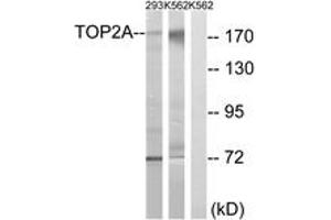 Western blot analysis of extracts from K562/293 cells, using TOP2A (Ab-1525) Antibody. (Topoisomerase II alpha anticorps  (AA 1482-1531))