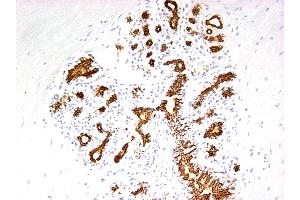 Image no. 1 for anti-Keratin 7 (KRT7) antibody (ABIN335326)
