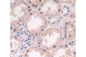 IHC-P analysis of Human Tissue, with DAB staining. (LRRFIP1 anticorps  (AA 128-250))