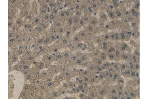 Detection of APOB in Rat Liver Tissue using Monoclonal Antibody to Apolipoprotein B (APOB)