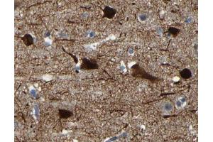 ABIN6268702 at 1/100 dilution staining MAP2 in human brain by Immunohistochemistry using paraffin-embedded tissue