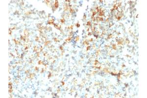 Formalin-fixed, paraffin-embedded human Testicular Cancer stained with FCGRT Mouse Monoclonal Antibody (FCGRT/2932).