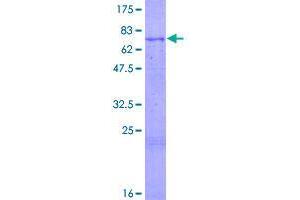 Image no. 1 for Chordin-Like 1 (CHRDL1) (AA 1-450) protein (GST tag) (ABIN1349384)