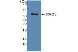 Detection of Recombinant ABCA1, Human using Polyclonal Antibody to ATP Binding Cassette Transporter A1 (ABCA1) (ABCA1 anticorps  (AA 1385-1663))