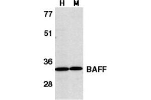 Image no. 2 for anti-Tumor Necrosis Factor (Ligand) Superfamily, Member 13b (TNFSF13B) (C-Term) antibody (ABIN204251) (BAFF anticorps  (C-Term))