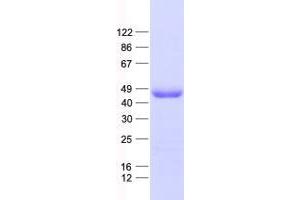 Validation with Western Blot