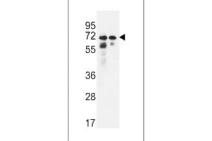 Western blot analysis in Hela,K562 cell line lysates (35ug/lane). (PNPLA8 anticorps  (N-Term))
