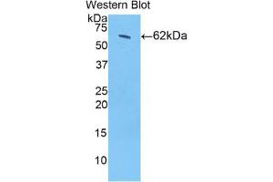 Western blot analysis of the recombinant protein. (HSD17B12 anticorps  (AA 1-312))