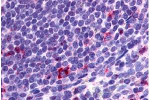 Anti-CCR2 antibody  ABIN1048390 IHC staining of human spleen, lymphocytes. (CCR2 anticorps  (N-Term))