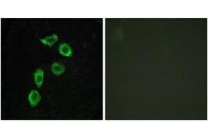 Immunofluorescence analysis of HuvEc cells, using GPR123 Antibody. (GPR123 anticorps  (AA 201-250))
