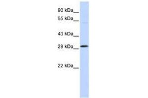 Image no. 1 for anti-Ovo-Like 2 (OVOL2) (C-Term) antibody (ABIN6740608) (OVOL2 anticorps  (C-Term))