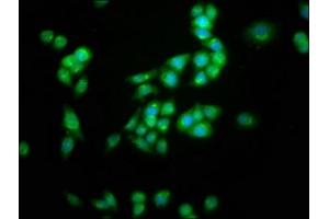 Immunofluorescence staining of PC-3 cells with ABIN7163969 at 1:100, counter-stained with DAPI. (KCNC3 anticorps  (AA 638-745))