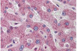 Human Liver: Formalin-Fixed, Paraffin-Embedded (FFPE)