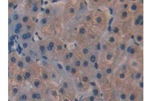 Detection of IL35 in Human Liver Tissue using Polyclonal Antibody to Interleukin 35 (IL35)