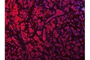 IF analysis of SEPTIN9 using anti-SEPTIN9 antibody (ABIN7600104). (Septin 9 anticorps  (AA 15-282))