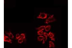 anti-Interleukin 10 Receptor, alpha (IL10RA) (pTyr496) antibody