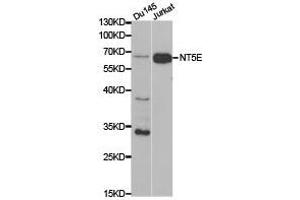 Western Blotting (WB) image for anti-5'-Nucleotidase, Ecto (CD73) (NT5E) antibody (ABIN1873965) (CD73 anticorps)