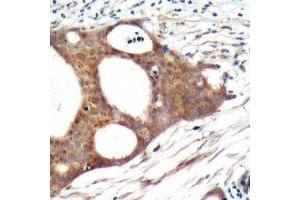 Immunohistochemistry (IHC) image for anti-Protein Arginine Methyltransferase 5 (PRMT5) antibody (ABIN7308234)