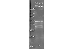 Goat anti Bilirubin Oxidase antibody  was used to detect Bilirubin Oxidase under reducing (R) conditions. (Bilirubin Oxidase anticorps  (HRP))